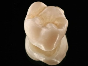 Bioker